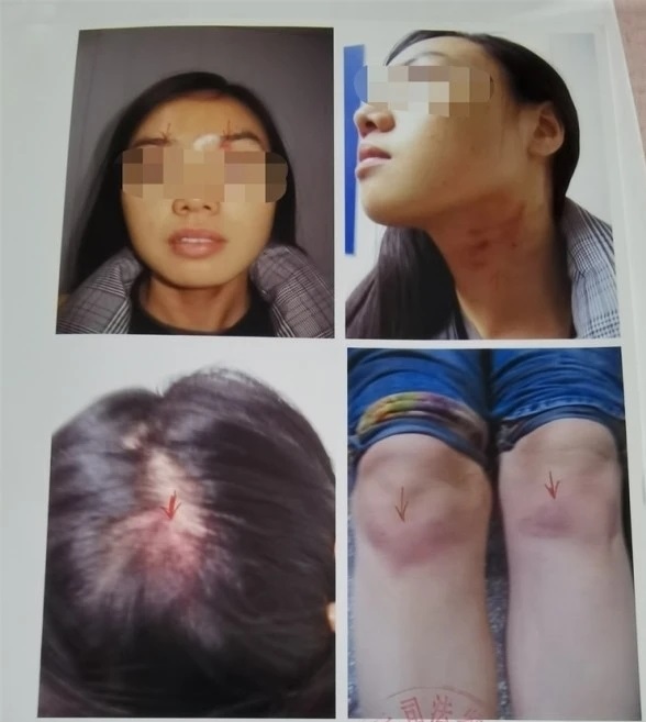 女子被家暴为何离婚难?