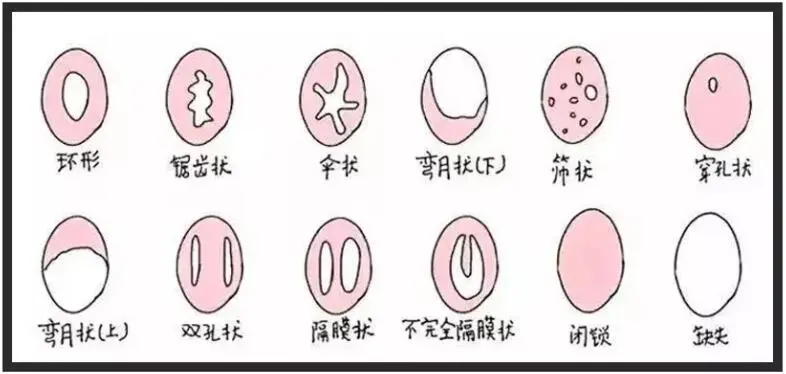 第一次进不去怎么办?