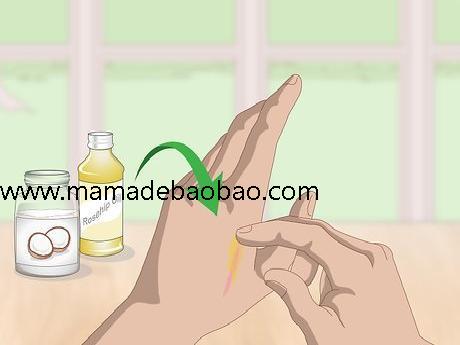 3种方法来去除疤痕（天然疗法）