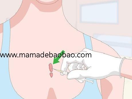 3种方法来去除疤痕（天然疗法）