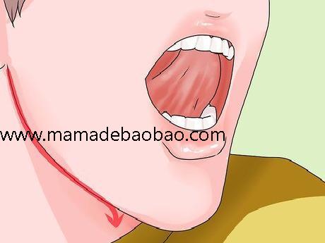 4种方法来在舌下喷口水（了解基本原理）