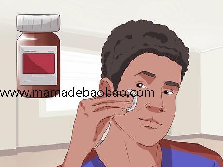 用3种方法朋友的妻子在一夜之间消除痘痘的红肿（使用天然产品）